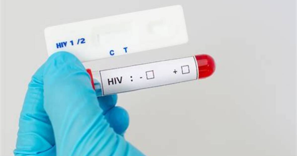 What Is a Sida Test