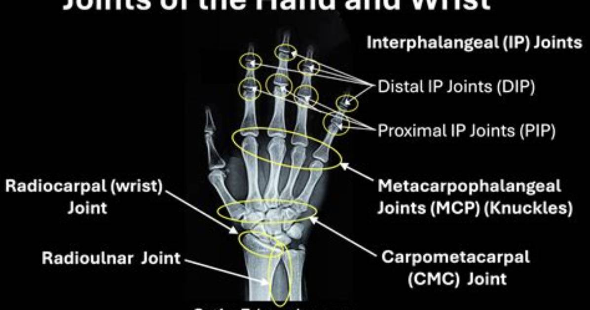 What Is a Small Joint Called