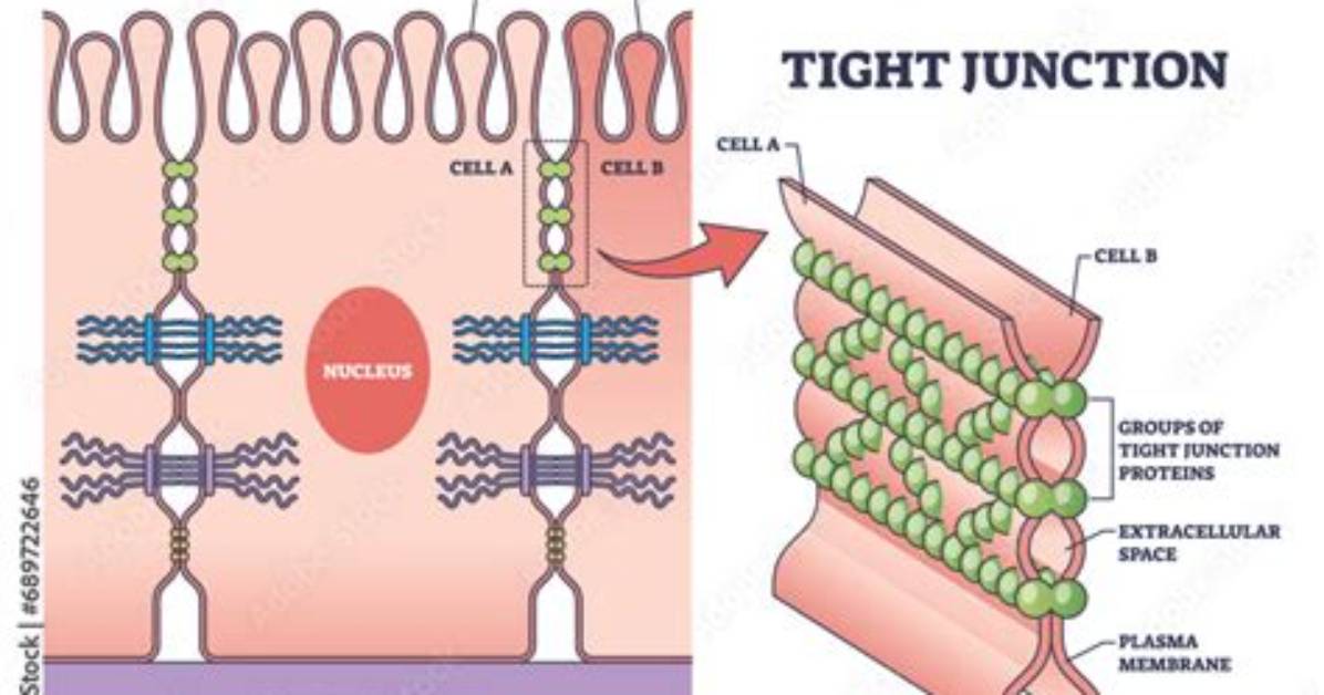What Is a Tight Junction