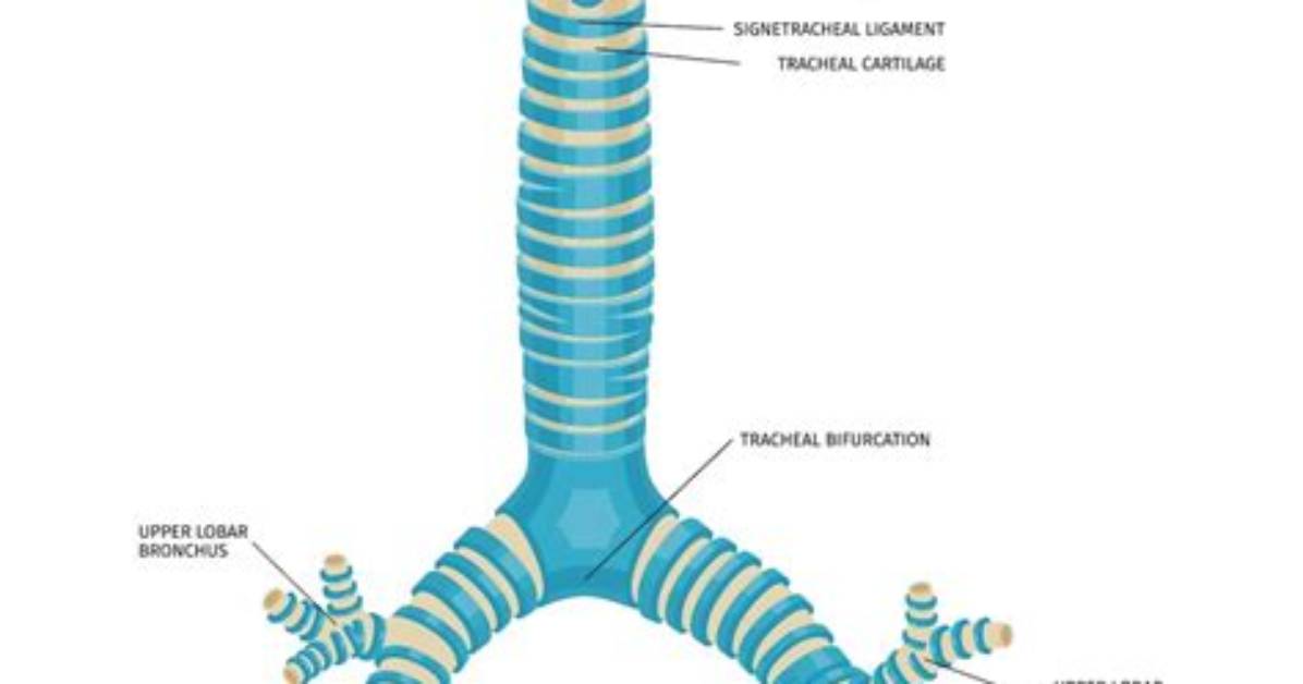 What Is a Tracheal?