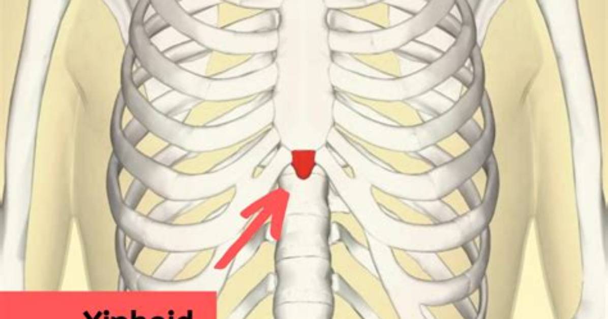 What Is a Xiphoid Definition?