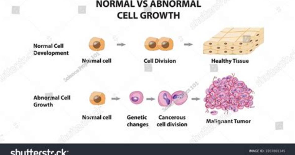 What Is Abnormal Development