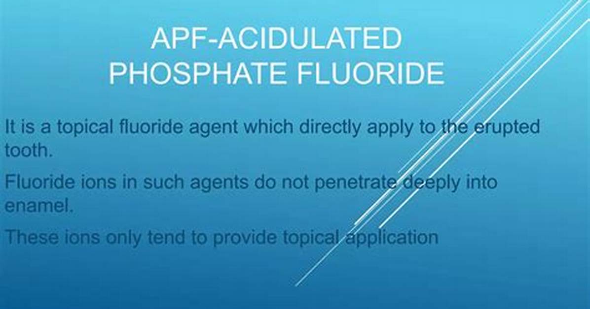 What Is Acidulated Phosphate Fluoride?