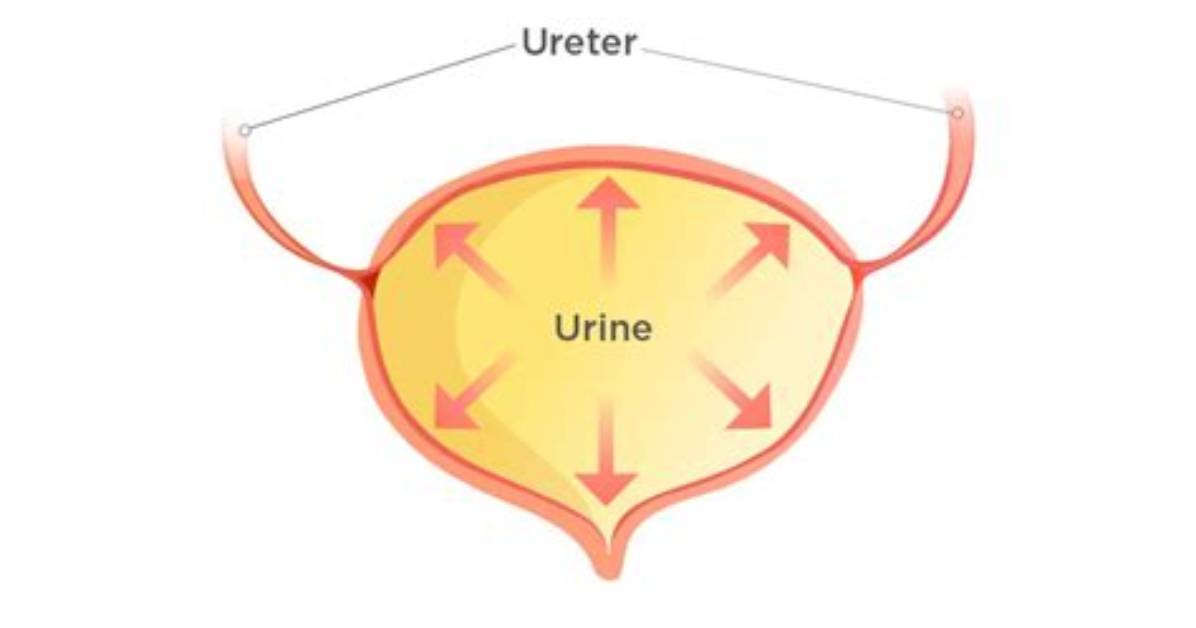 What Is an Atonic Bladder