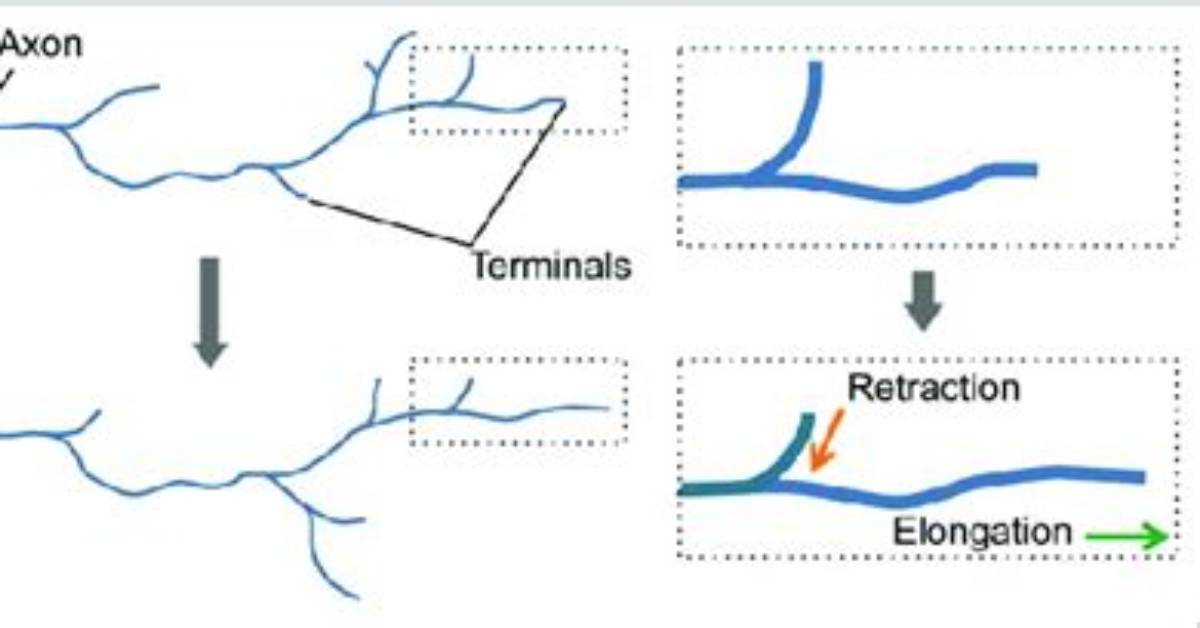 What Is an Axonal Arbor