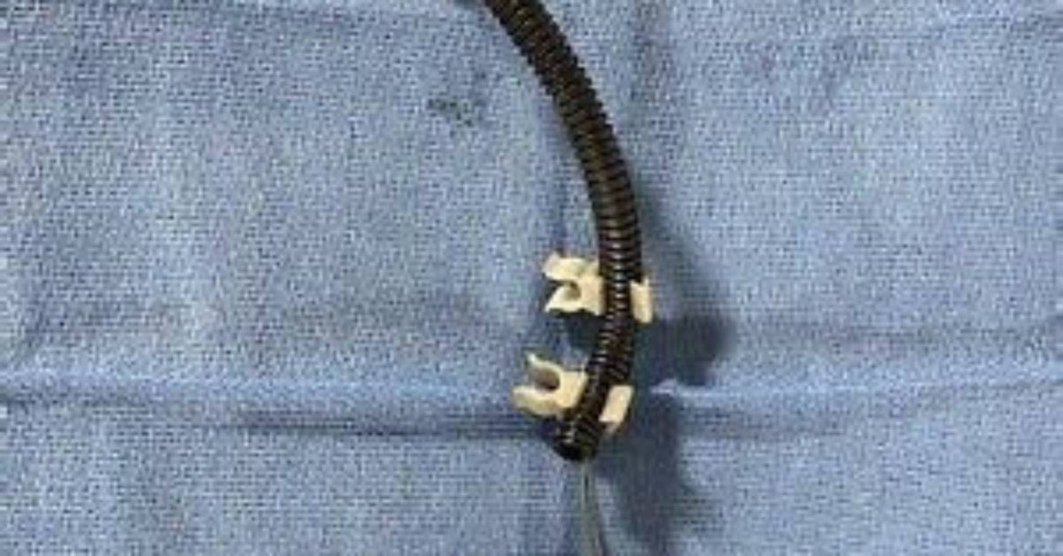 What Is an Evo Sensor