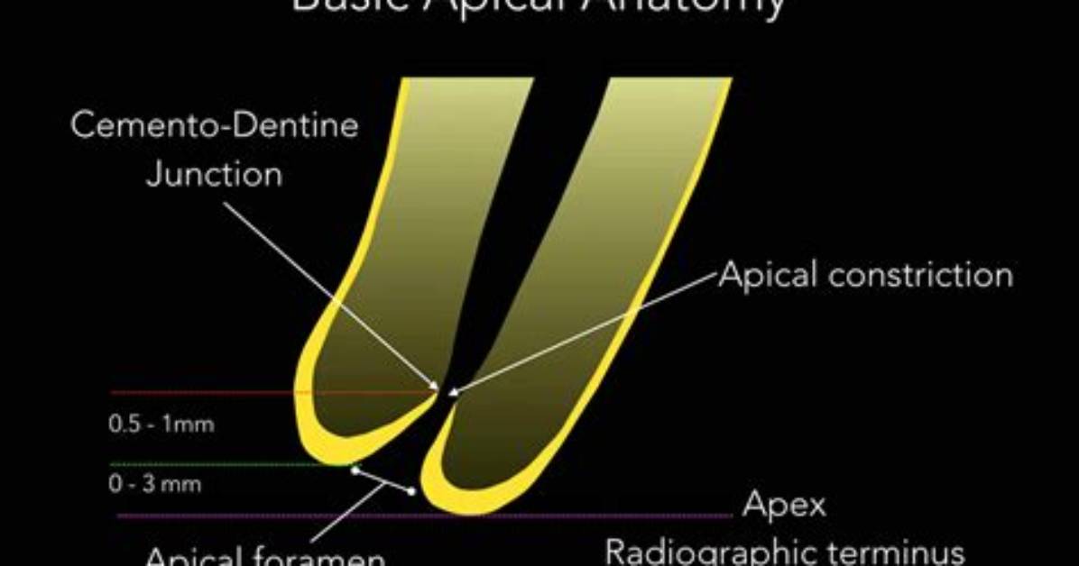 What Is Apical Dentistry