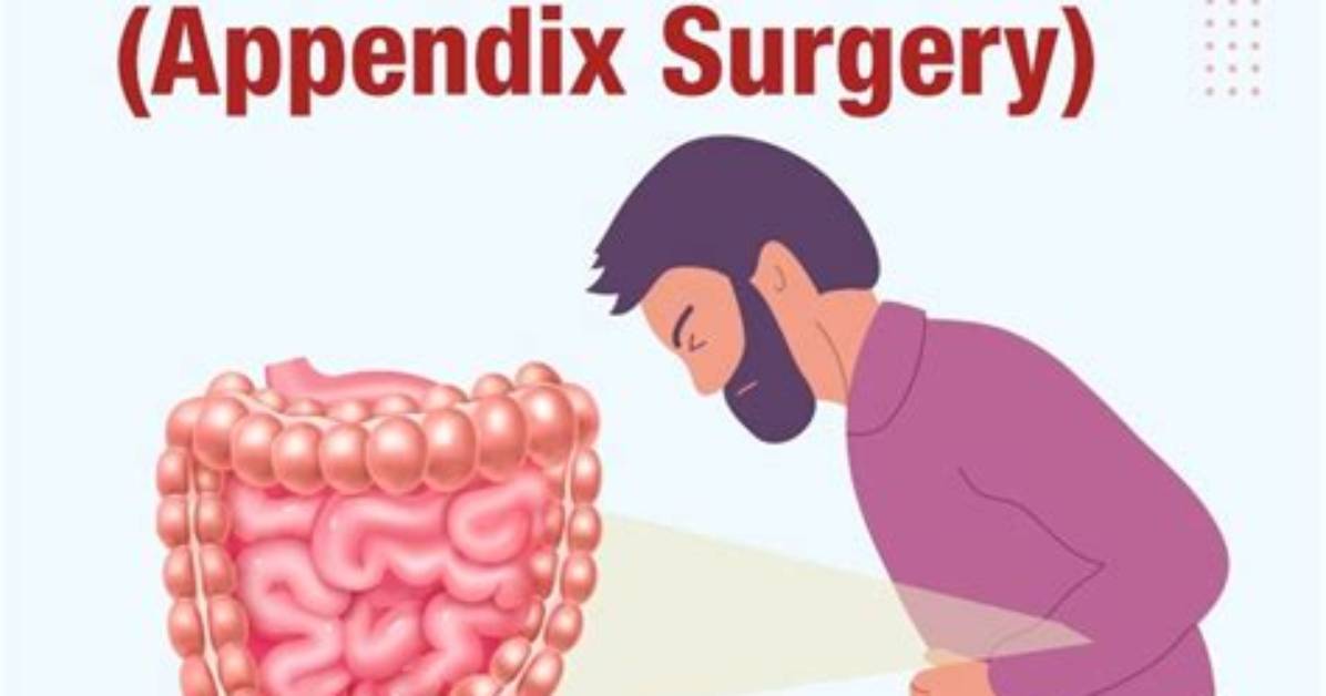 What Is Appendectomy Surgery?