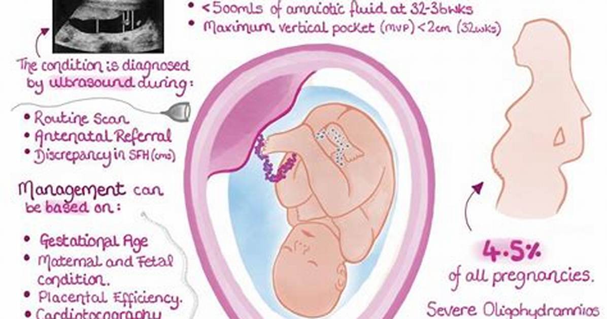 What Is Borderline Oligohydramnios?