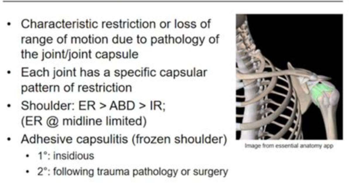 What Is Capsular Pattern?
