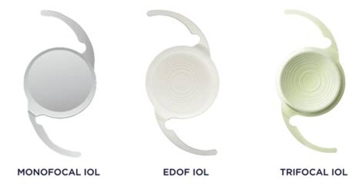 What Is Ceiol