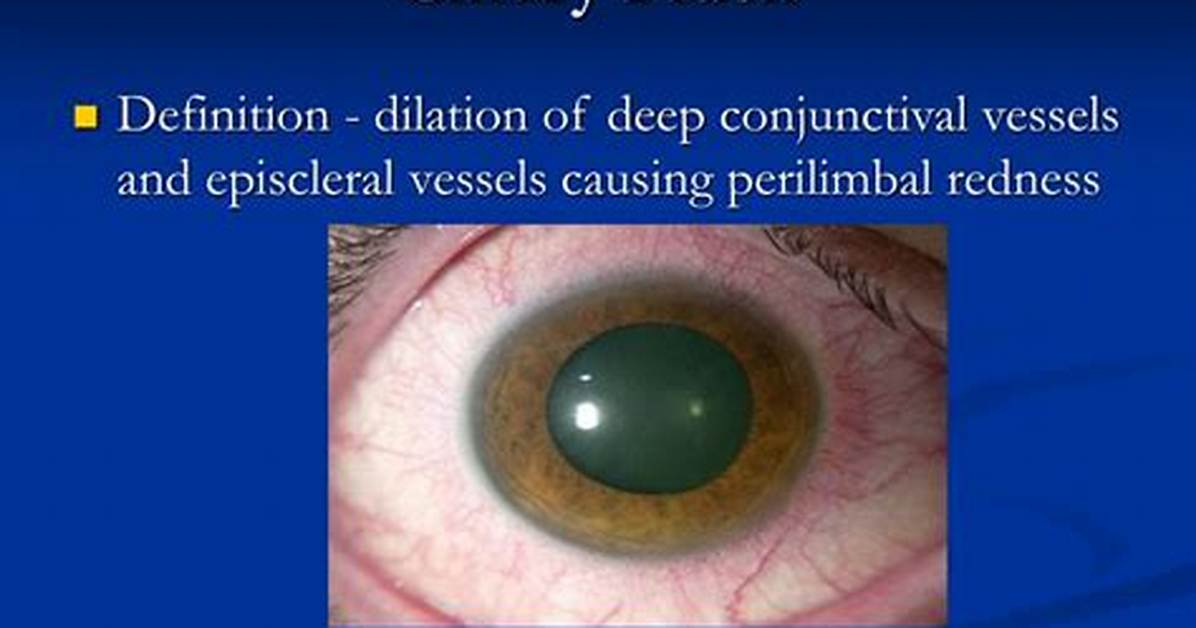 What Is Ciliary Flush