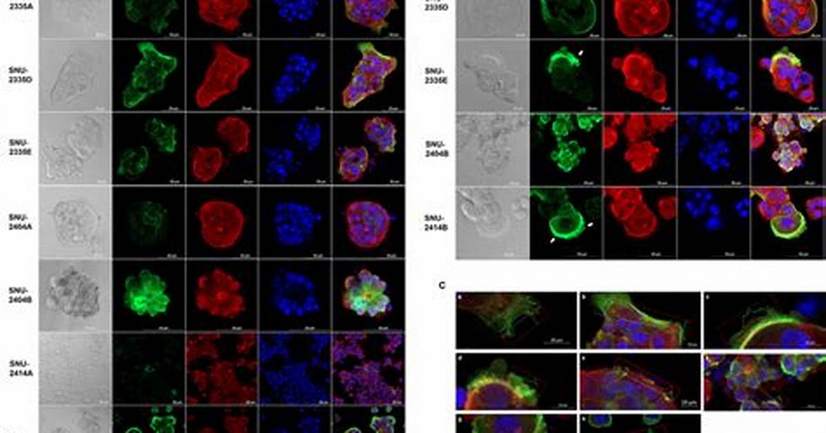 What Is Colonized Cell?