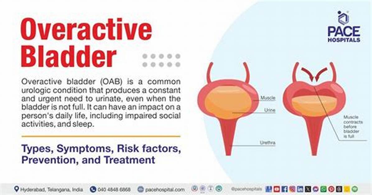 What Is Considered an Overactive Bladder
