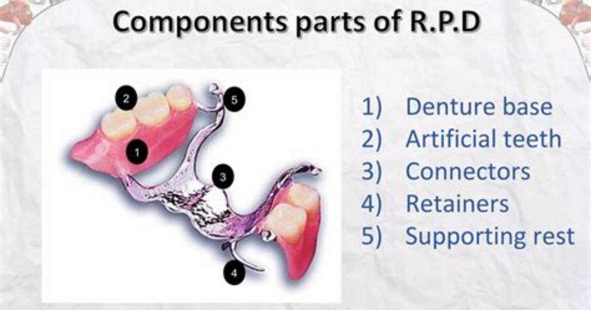 What Is Denture Rest