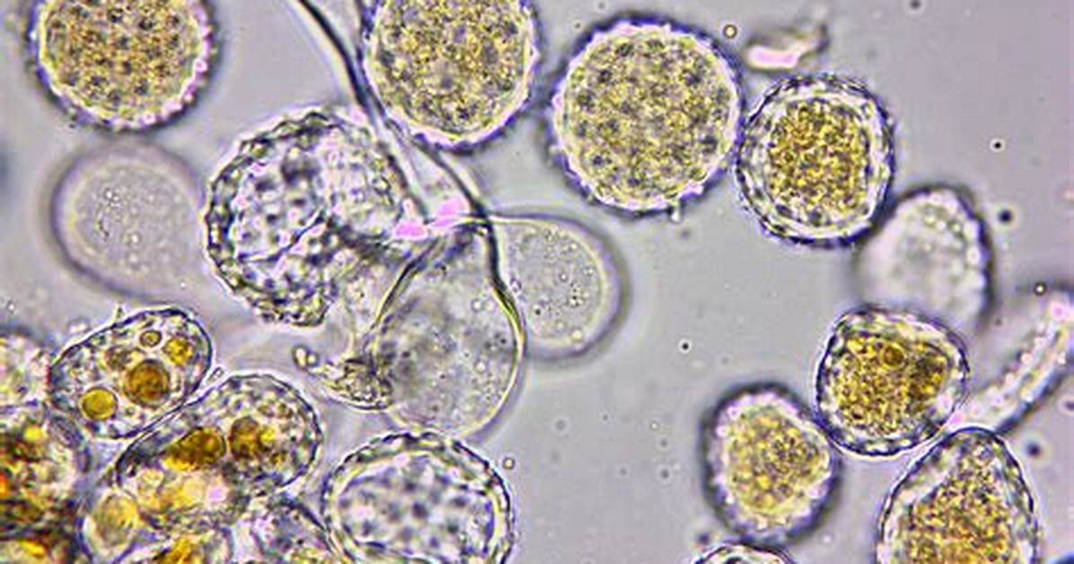 What Is Difference Between Teliospore and Uredospore?