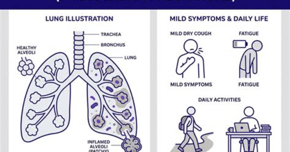 What Is Difference Between Walking Pneumonia and Pneumonia