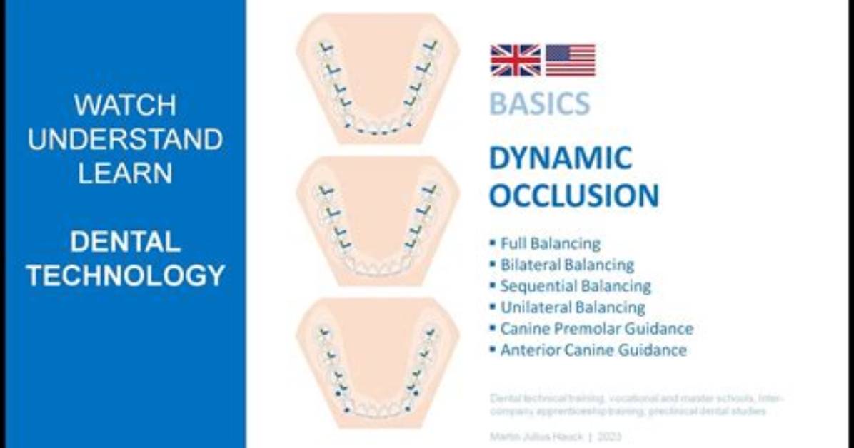 What Is Dynamic Occlusion