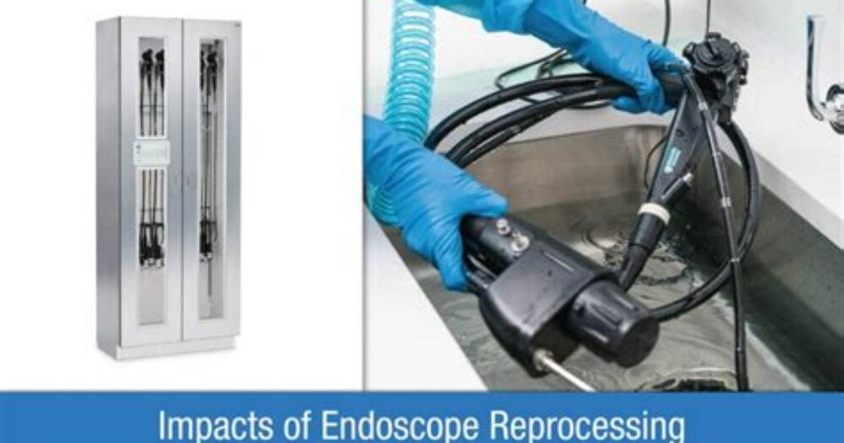 What Is Endoscope Reprocessing?