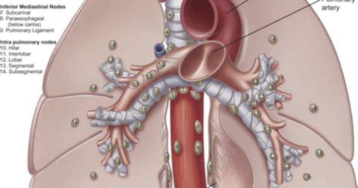 What Is Fissural Lymph Node?