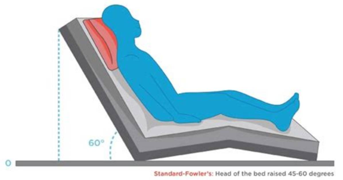 What Is Fowler's Position?