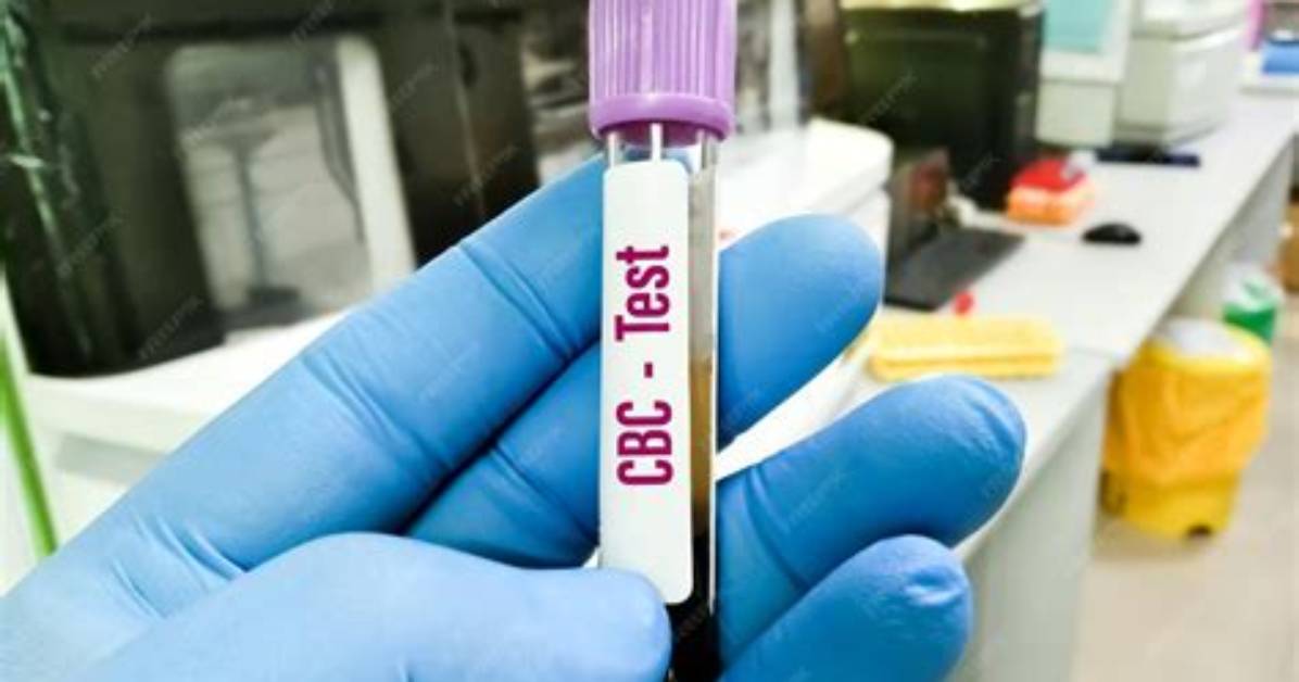 What Is Hematological Test?