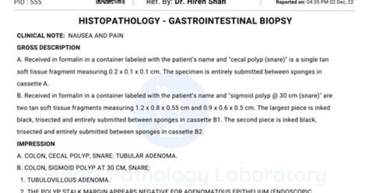 What Is Histopathology Report? | Contextresponse. Com