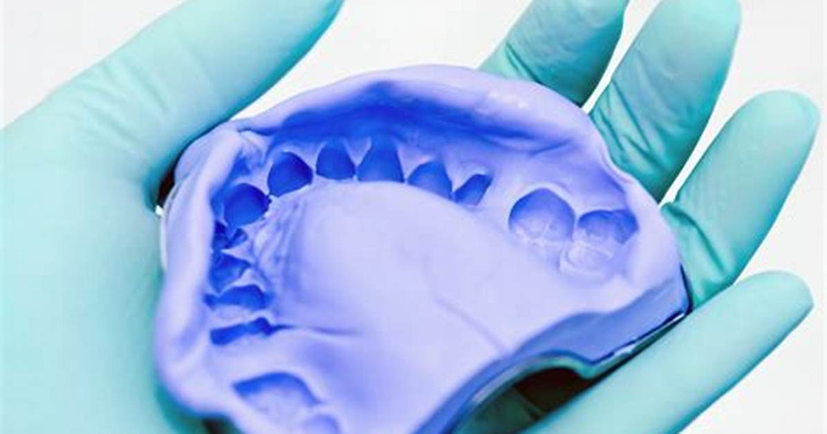 What Is Impression Plaster in Dentistry?