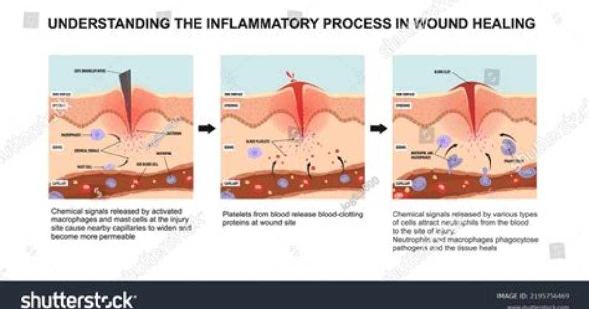 What Is Inflammatory Phase