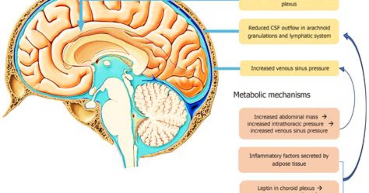 What Is Intracranial Process?