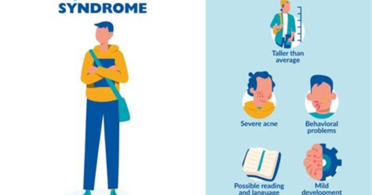 What Is Jacob's Syndrome Symptoms?