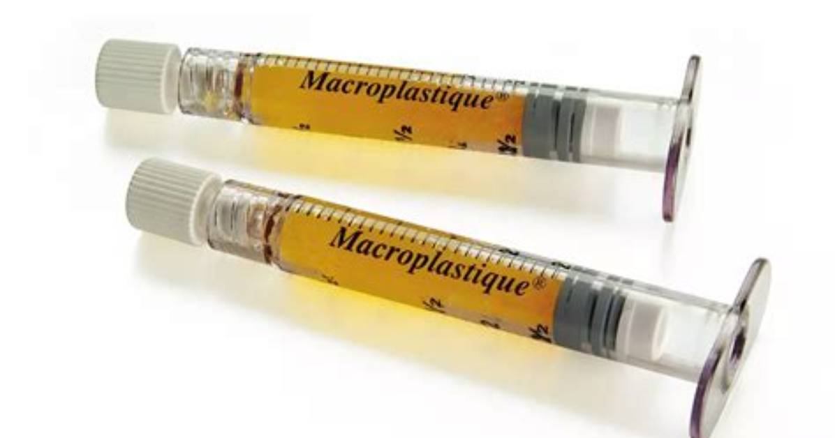 What Is Macroplastique