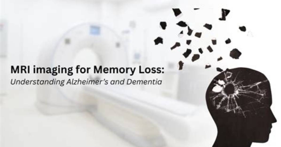 What Is Memory Imaging