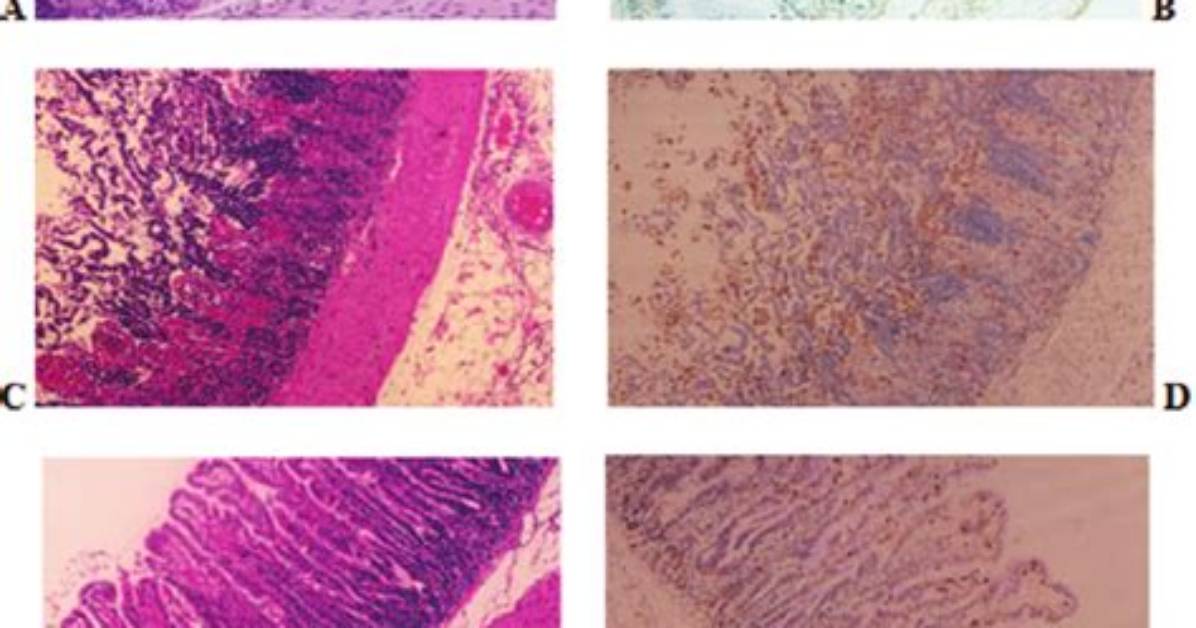 What Is Mucosal Disruption