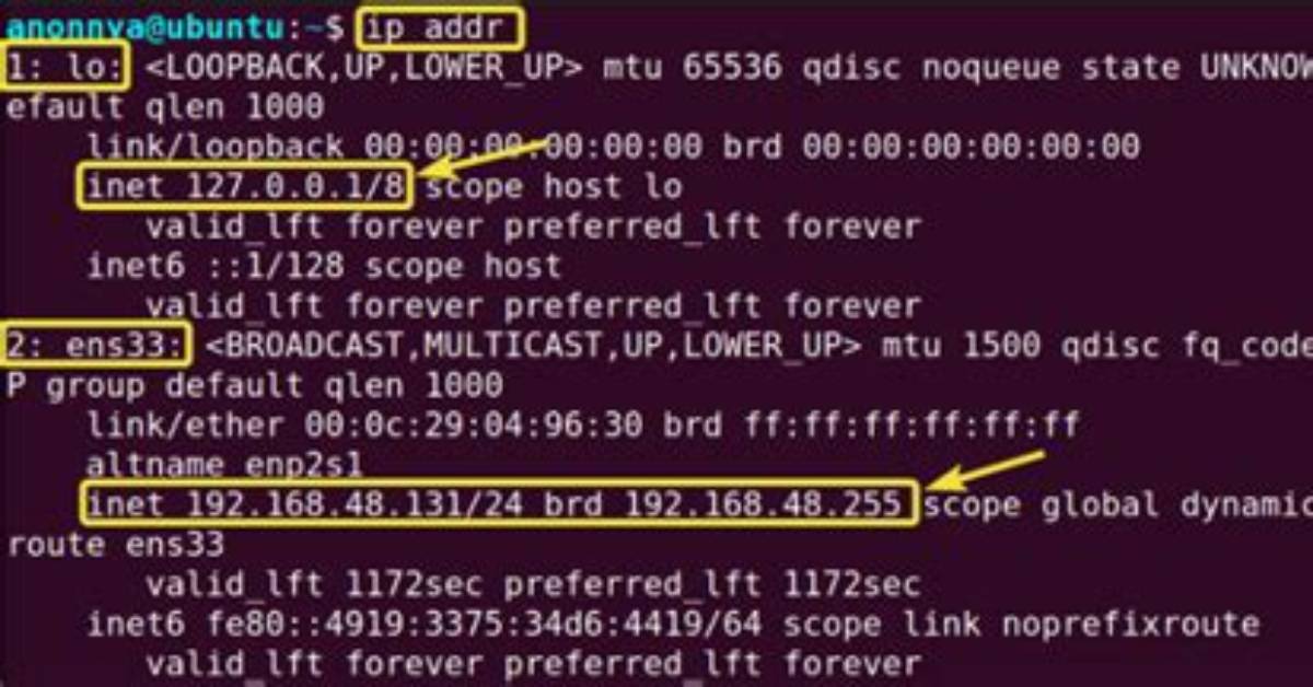 What Is My Ip Address Linux Command Line?