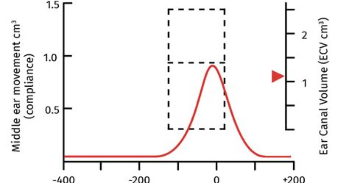 What Is Normal Ear Pressure