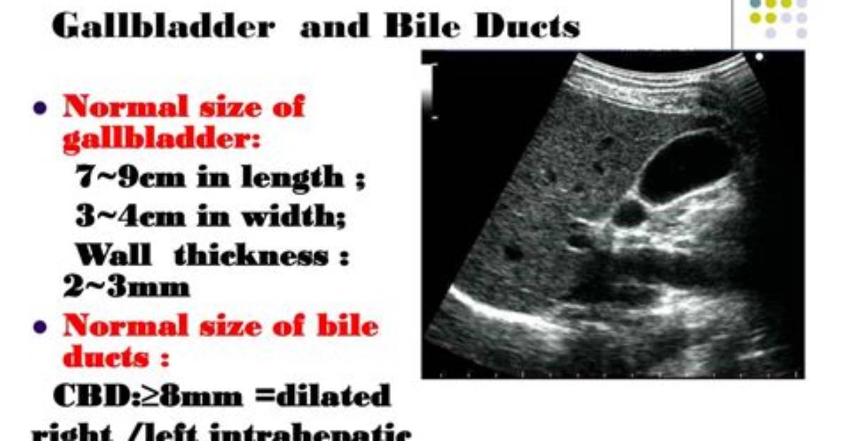 What Is Normal Gallbladder Wall Thickness