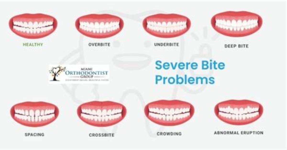 What Is Orthognathic Bite?
