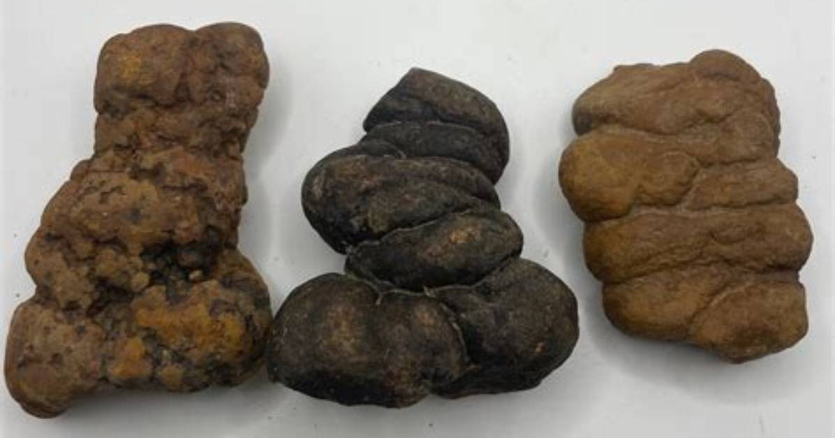What Is Petrified Poop? | Contextresponse. Com