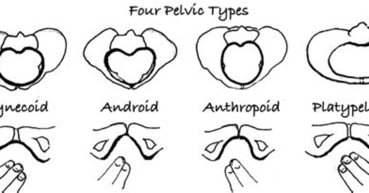 What Is Platypelloid?