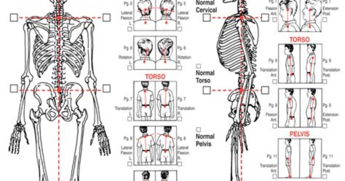 What Is Postural Analysis