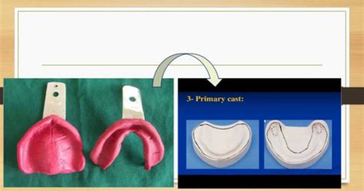 What Is Primary Cast