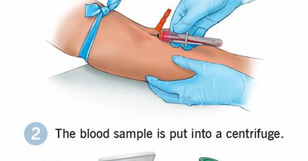 What Is Prp Injection?