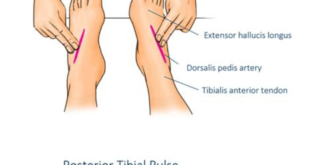 What Is Pt Pulse
