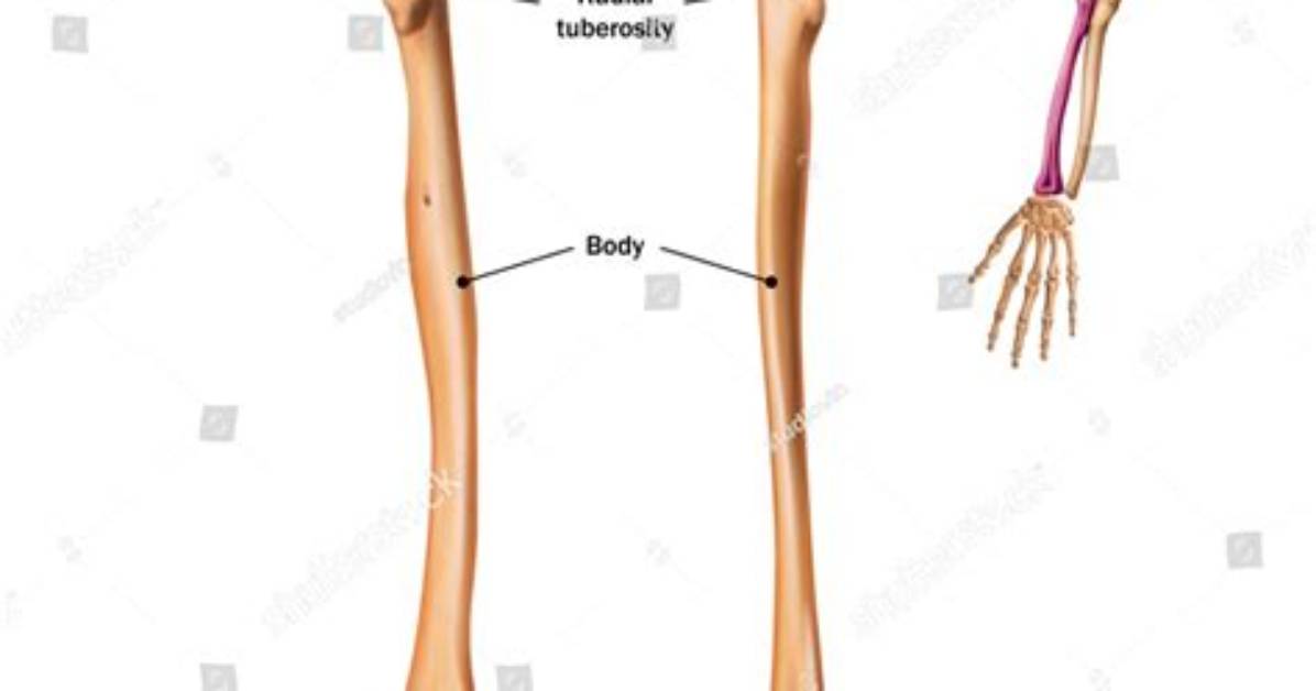 What Is Radial Bone?