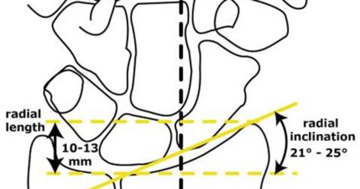 What Is Radial Length
