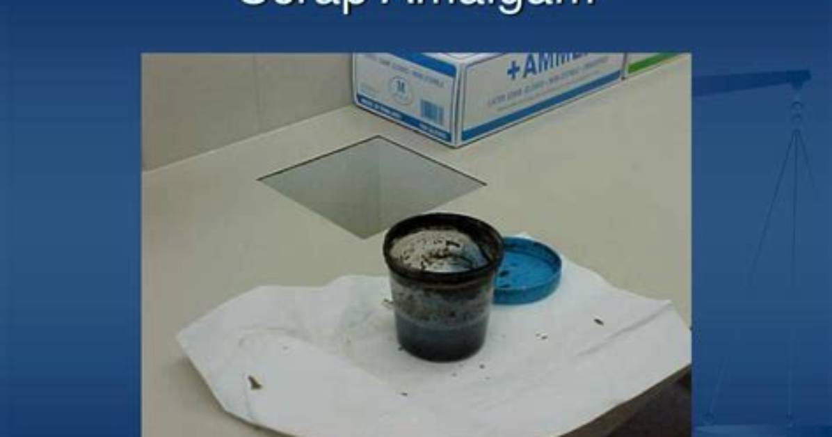 What Is Scrap Amalgam?