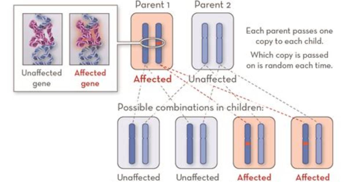 What Is Single Gene Defect