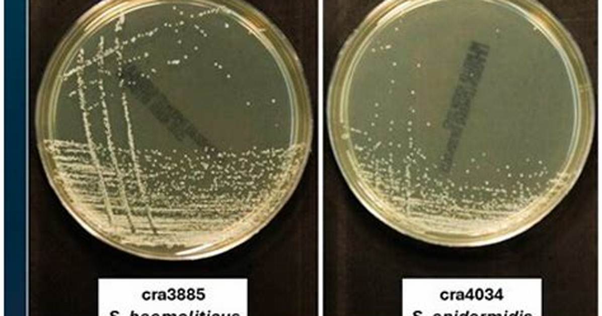 What Is Test That Differentiates S. Epidermidis and S. Saprophyticus?