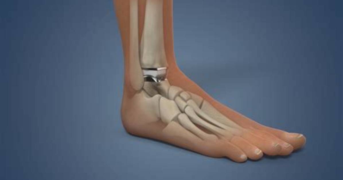 What Is the Ankle